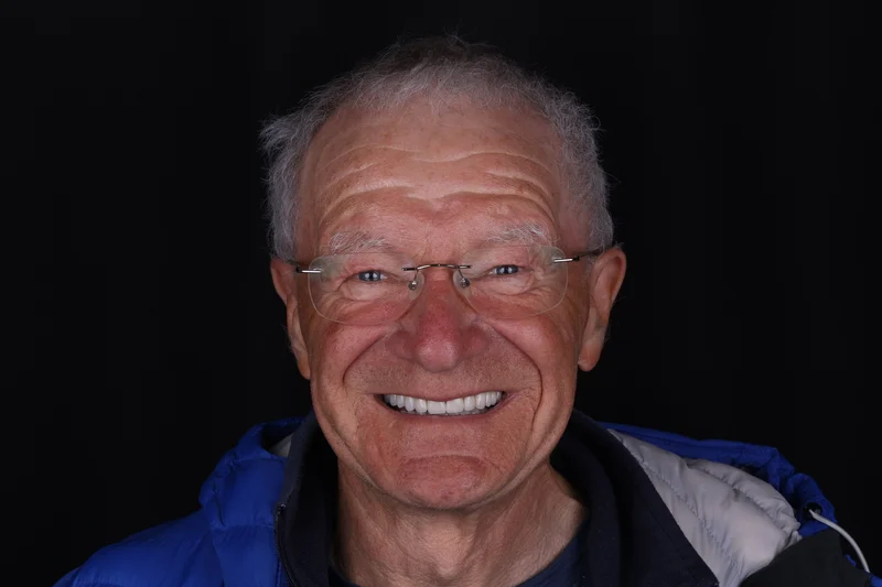 David after dental implant treatment