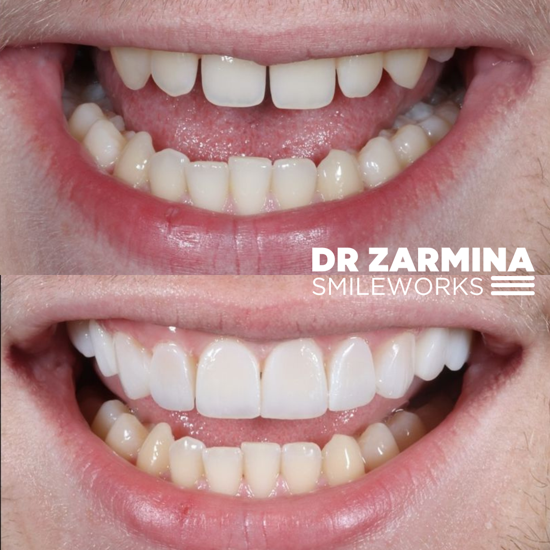 zarmina smile makeover